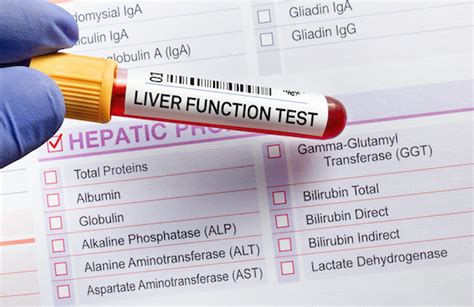 Interpreting Hepatic Test