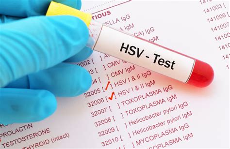 Introduction to HSV Tests