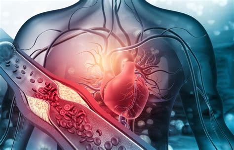 Introduction to Heart Attack Survival Statistics