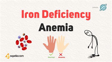 Iron Deficiency and Anemia