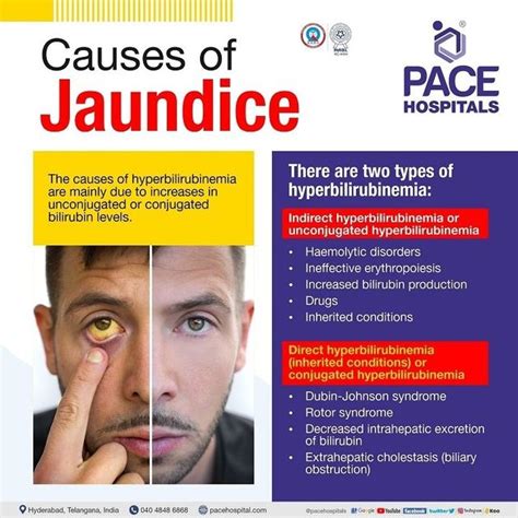 Jaundice Causes