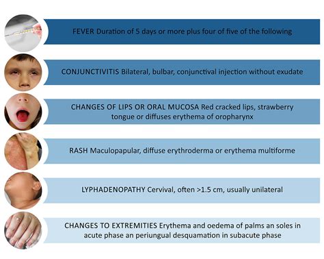 Kawasaki Disease Prevention