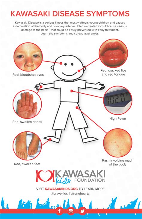 Kawasaki Disease Support