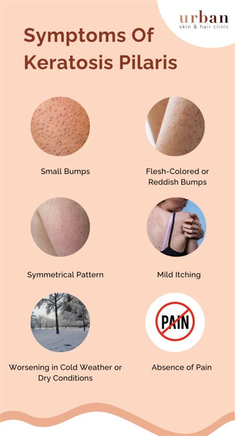 Keratosis Pilaris Symptoms