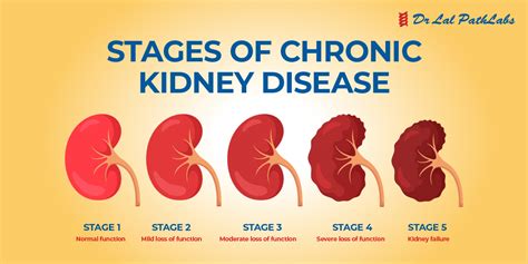 Kidney Disease and Other Health Conditions