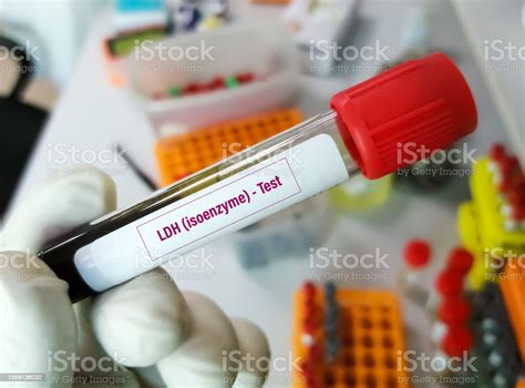 LD Blood Test and Disease Diagnosis