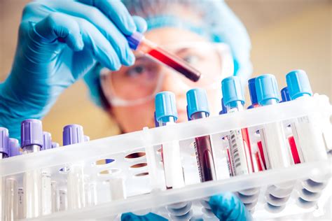Laboratory Tests for Lyme Disease