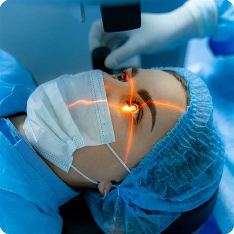 Laser Cataract Surgery