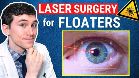Laser Therapy for Eye Floaters