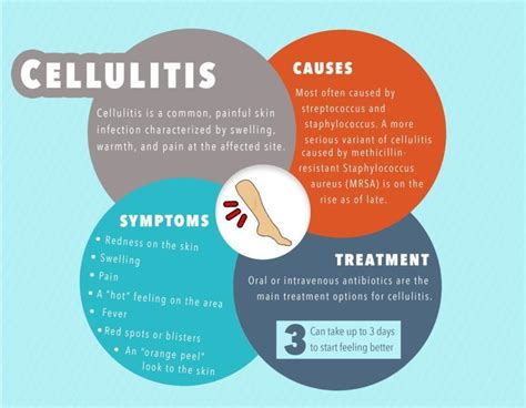 Lifestyle Changes to Prevent Cellulitis