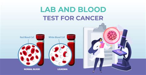 Limitations And Risks Of Blood Tests For Blood Cancer Detection