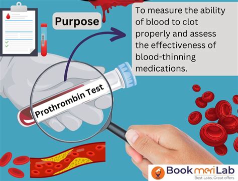 Limitations and Risks of 5 PTT Blood Tests