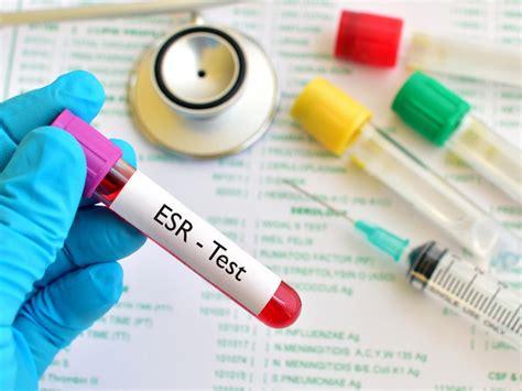 Limitations of ESR Test