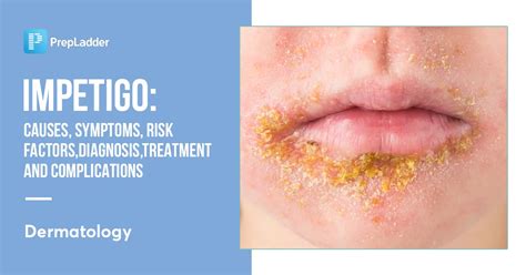 Living with Impetigo