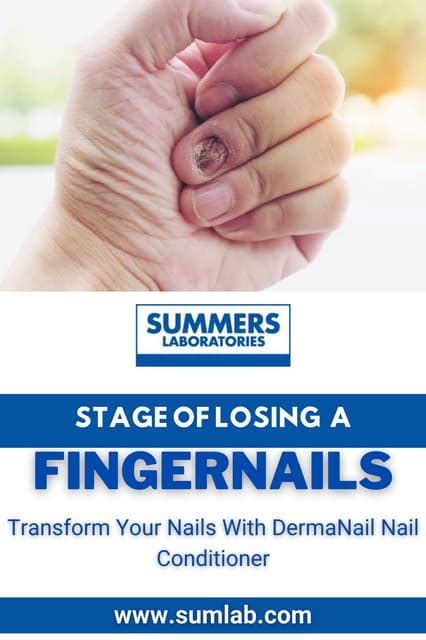 Losing A Fingernail Stages Overview