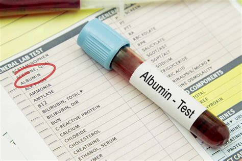 Low Albumin Blood Test Results Explained