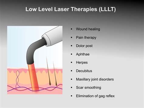 Low-Level Laser Therapy