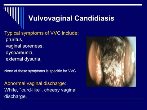 Lower Genital Tract Symptoms