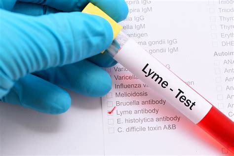 Lyme Disease Blood Test Accuracy