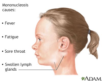 Lymph Node Under Chin Pain in Children