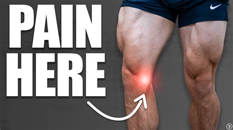 MCL Pain Prevention