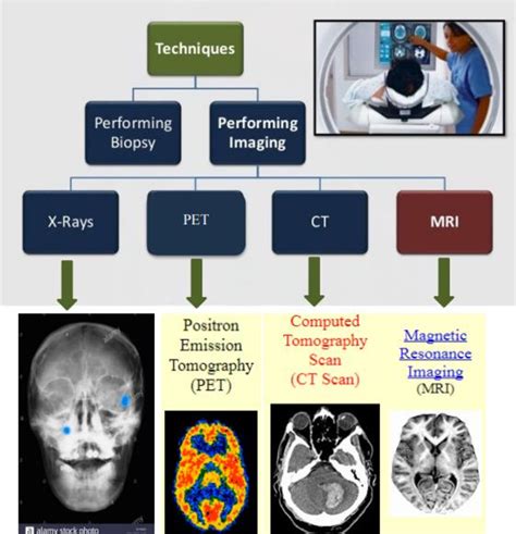 MRI Brain Scan Techniques