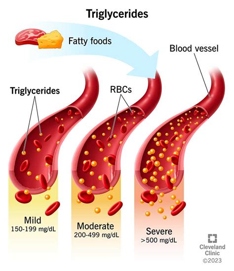 Maintaining Normal Triglyceride Levels