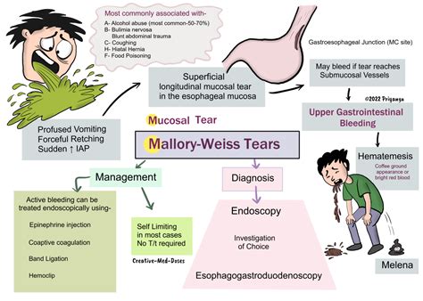 Mallory Weiss Tear Causes