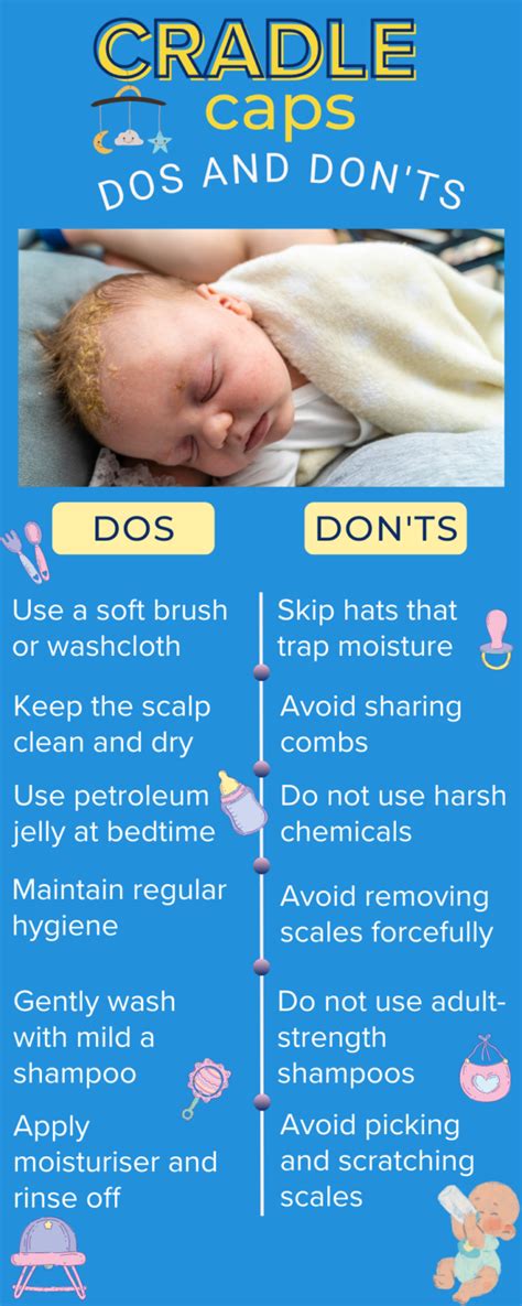Managing Cradle Cap