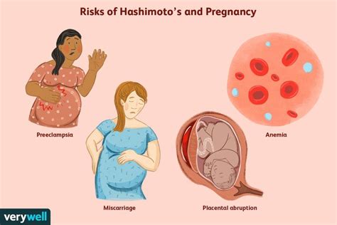 Managing Hashimoto's During Pregnancy
