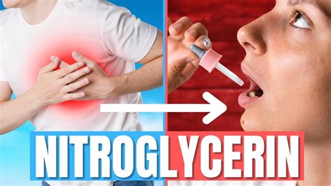 Managing Nitroglycerin Side Effects