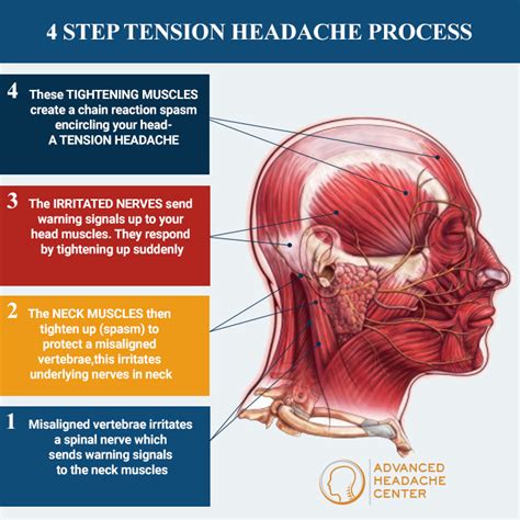 Managing Stress and Headaches