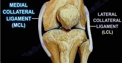 Medial Collateral Ligament Sprain