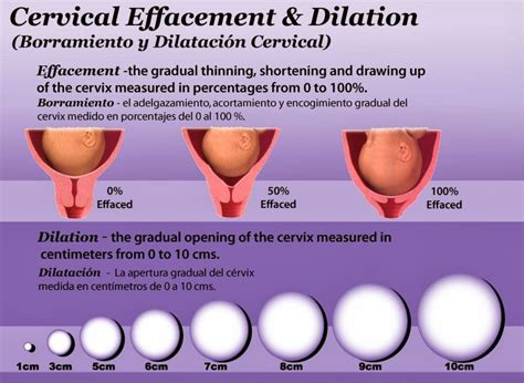 Medical Interventions for 3 cm Dilation
