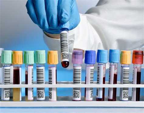 Medical Tests and Blood Typing