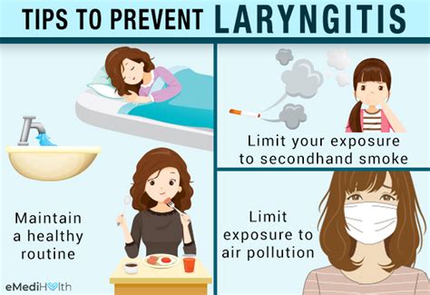 Medical Treatment for Laryngitis