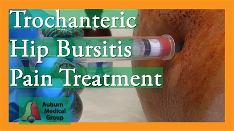 Medical Treatments for Bursitis