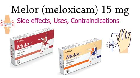Meloxicam for Pain Management