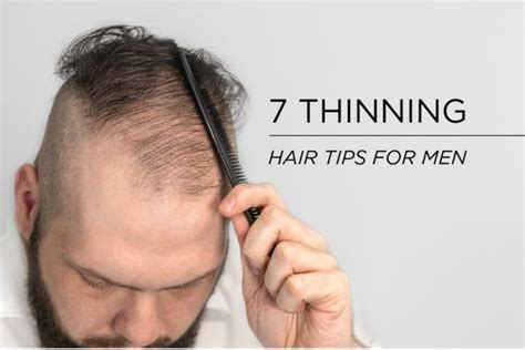 Men's Hair Thinning Treatment Options