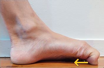 Metatarsal Phalangeal Joint Exercises