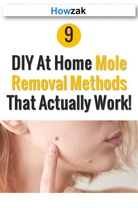 Methods of Mole Removal