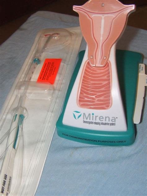 Mirena IUD FAQs