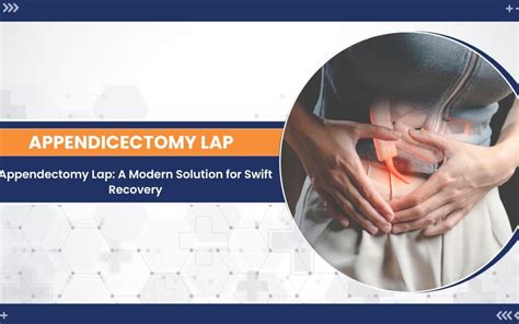 Modern Advances in Appendectomy