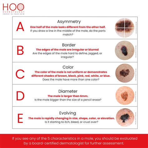 Monitoring Moles for Changes