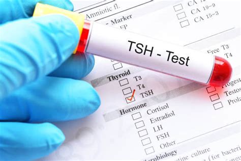 Monitoring Thyroid Function with TSH Test