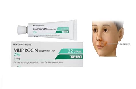 Mupirocin Ointment Mechanism