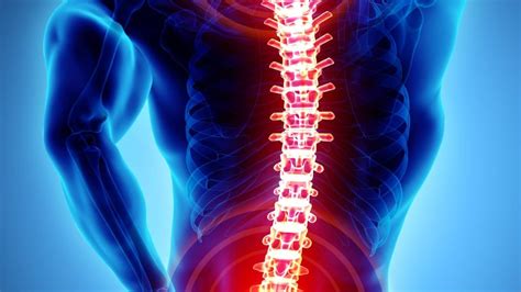 Musculoskeletal Problems