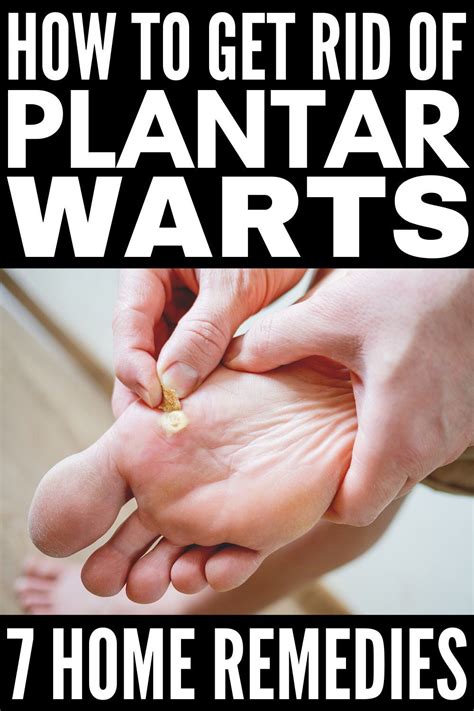 Natural Methods for Removing Plantar Warts