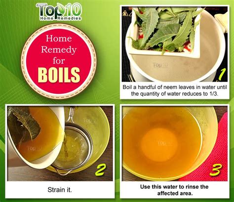 Natural Remedies for Boil Prevention