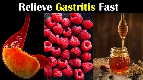 Natural Remedies for Gastritis